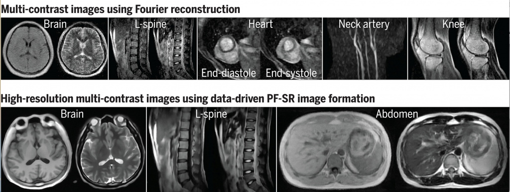 （上）使用傳統影像重建的各種解剖結構的典型影像 （下）透過利用大規模高場 MRI 數據，使用深度學習形成的高解析度影像