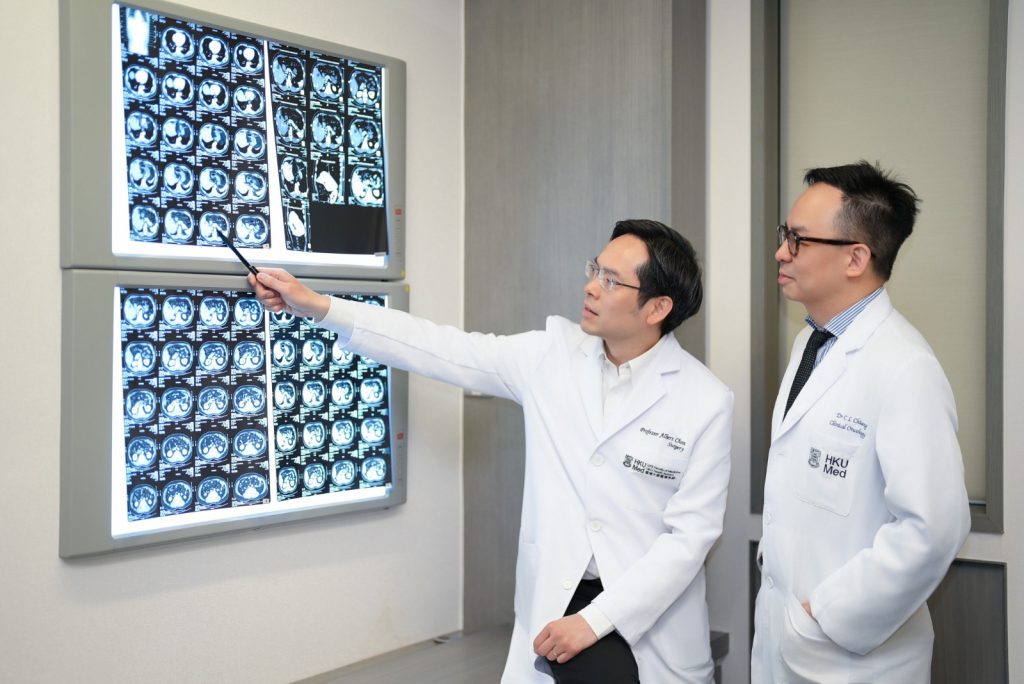 The LRT-IO approach is a potentially curative treatment for large, unresectable liver cancer, with a 46% complete response rate, and a 75% survival rate among patients who achieved a complete response. The photo shows Professor Albert Chan Chi-yan (left) and Dr Chiang Chi-leung. 局部和免疫治療聯合療法方案對體積較大、無法進行手術切除的肝癌具有根治潛力，其完全緩解率達到46%，而獲完全緩解患者的存活率更高達75%。圖為陳智仁教授（左）和蔣子樑醫生。