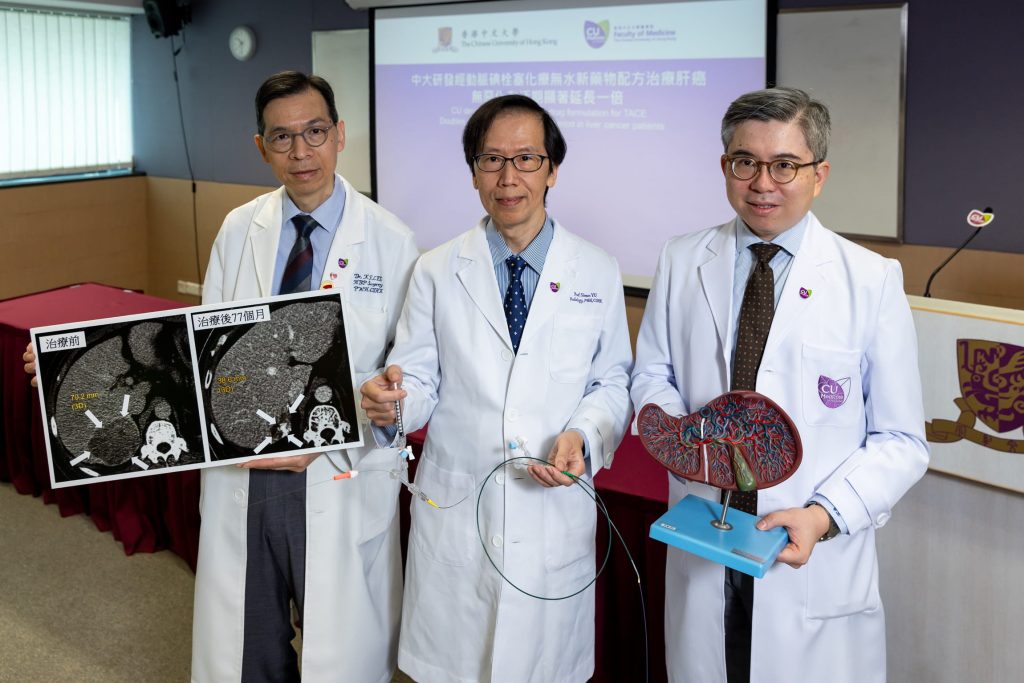 中大醫學院影像及介入放射學系於傳統「經動脈碘栓塞化療」基礎上，研發出以無水純化療藥新配方。臨床研究顯示新配方多項治療成效指標上均較傳統療法好，有望為中期肝細胞癌患者提供多一個治療方案。 （左起）中大醫學院外科學系肝膽胰外科名譽臨床副教授李傑輝醫生、中大醫學院影像及介入放射學系名譽臨床教授余俊豪教授，以及葉氏家族基金腫瘤學教授兼中大醫學院腫瘤學系陳林教授。
