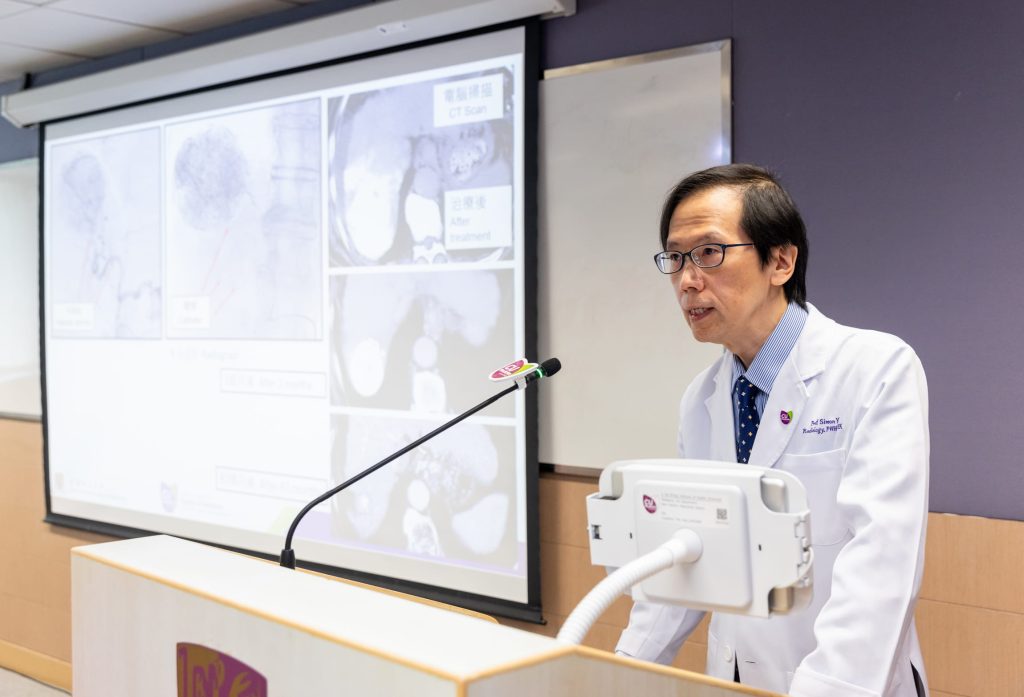 余俊豪教授表示，新配方利用無水純化療藥在血液中緩慢溶解的特性，令藥物可以在腫瘤內長時間維持高濃度，並持續釋放藥物，有效解決傳統配方藥物容易隨血液快速流失的缺點。